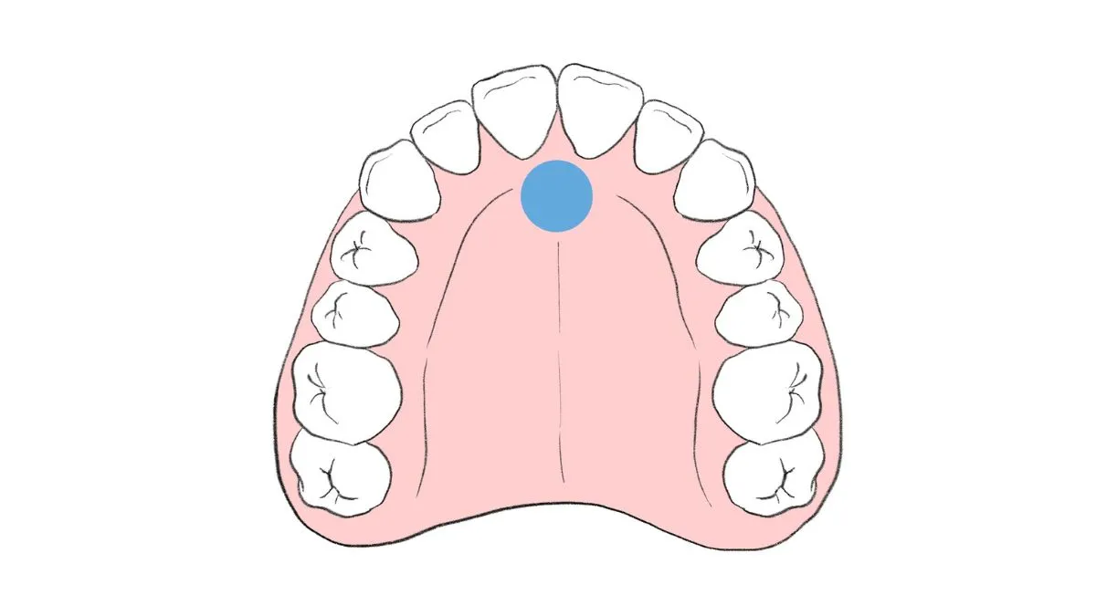 指しゃぶりで歯並びが悪くなるのは本当？月齢別見極めガイド
